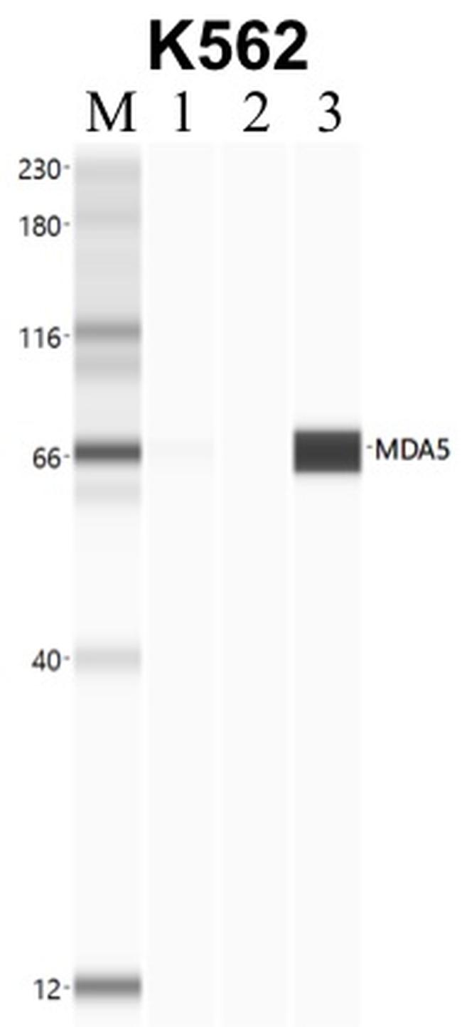 MDA5 Antibody in RNA Immunoprecipitation (RIP)