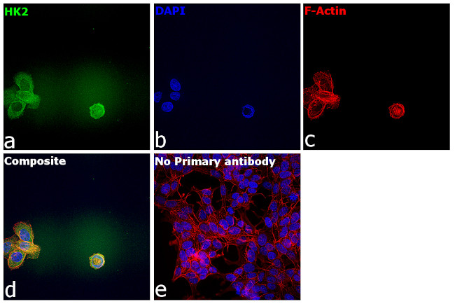 HK2 Antibody in Immunocytochemistry (ICC/IF)