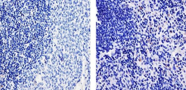 TARC Antibody in Immunohistochemistry (Paraffin) (IHC (P))