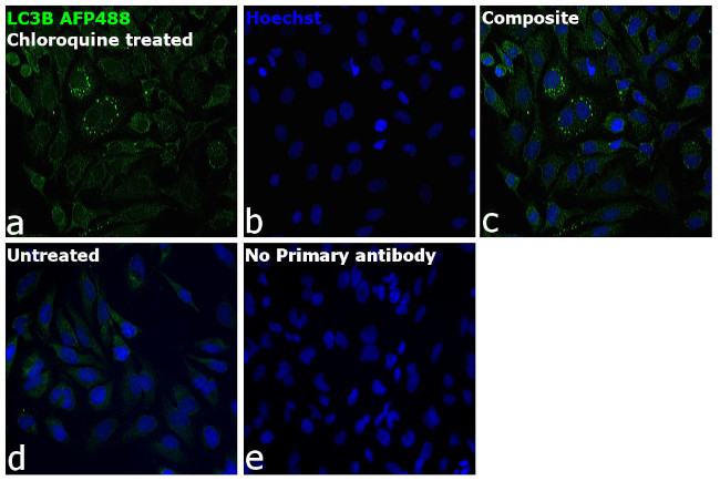 LC3B Antibody in Immunocytochemistry (ICC/IF)