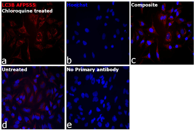 LC3B Antibody in Immunocytochemistry (ICC/IF)