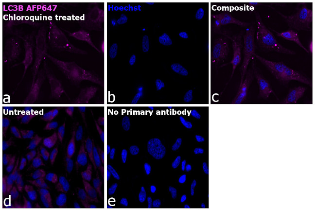 LC3B Antibody in Immunocytochemistry (ICC/IF)