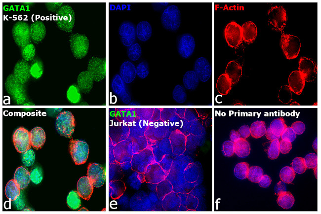 GATA1 Antibody in Immunocytochemistry (ICC/IF)