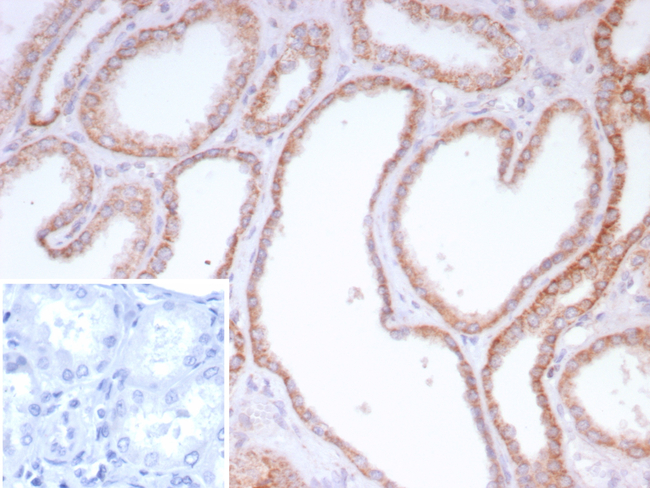 CD202b/TIE2/TEK (Tyrosine Kinase with Ig and EGF Homology Domains 2) Antibody in Immunohistochemistry (Paraffin) (IHC (P))