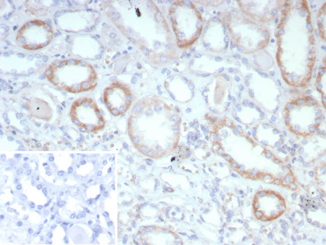 CD202b/TIE2/TEK (Tyrosine Kinase with Ig and EGF Homology Domains 2) Antibody in Immunohistochemistry (Paraffin) (IHC (P))