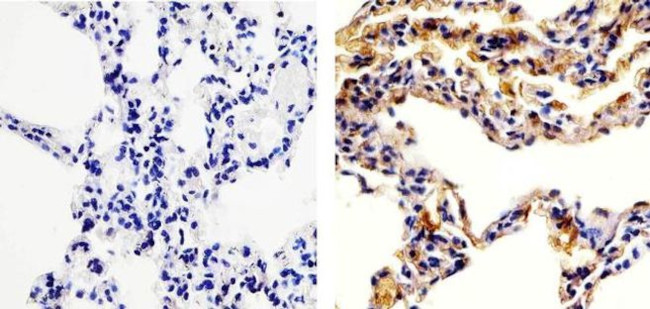 CCL5 (RANTES) Antibody in Immunohistochemistry (Paraffin) (IHC (P))
