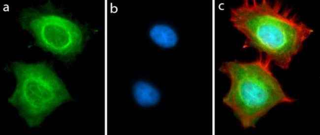 NAMPT Antibody in Immunocytochemistry (ICC/IF)