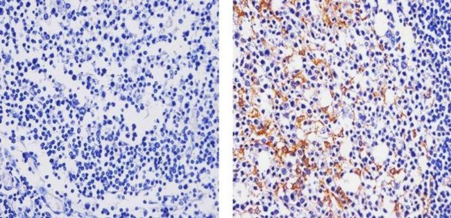 CCL3 Antibody in Immunohistochemistry (Paraffin) (IHC (P))