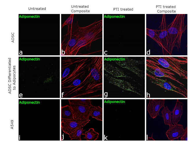 Adiponectin Antibody (701148)