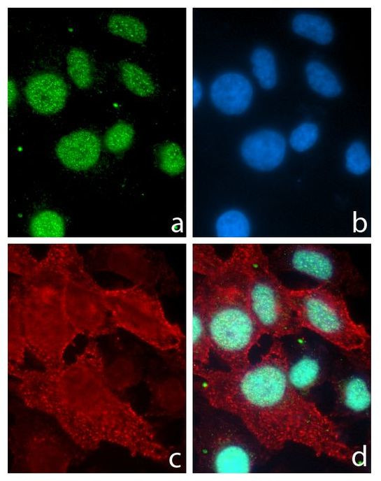 PITX3 Antibody in Immunocytochemistry (ICC/IF)
