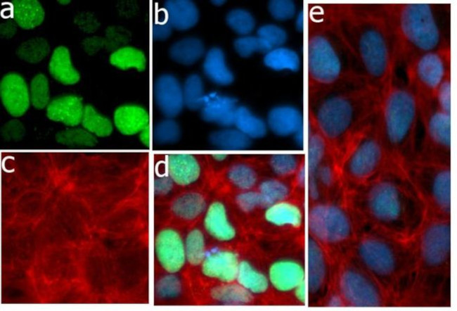 Acetyl-p53 (Lys382) Antibody in Immunocytochemistry (ICC/IF)