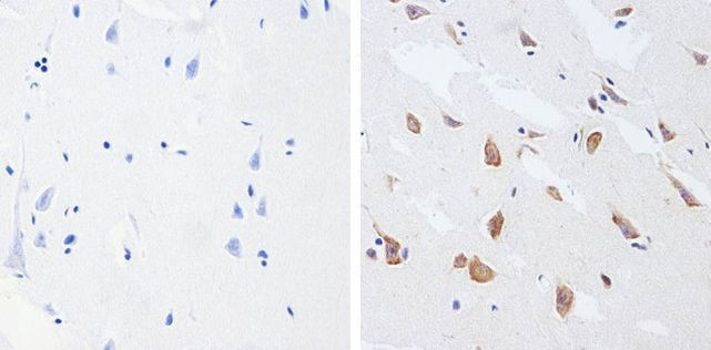 Phospho-Tau (Thr181) Antibody in Immunohistochemistry (Paraffin) (IHC (P))