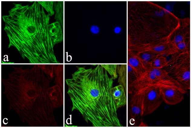 Troponin I Antibody in Immunocytochemistry (ICC/IF)