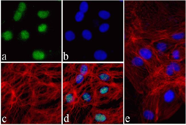 Nkx2.5 Antibody in Immunocytochemistry (ICC/IF)