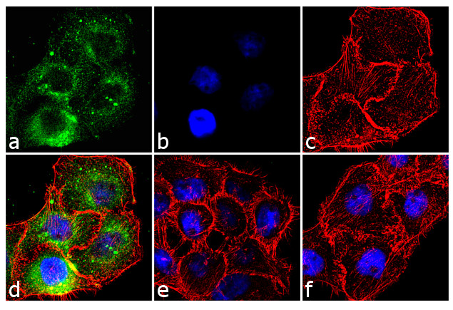 Phospho-EGFR (Tyr1173) Antibody in Immunocytochemistry (ICC/IF)