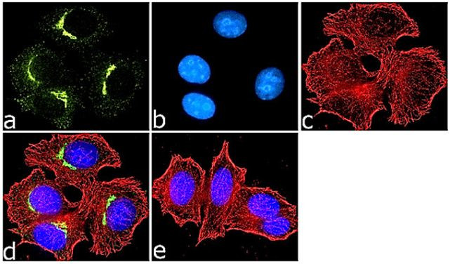 Syntaxin 6 Antibody in Immunocytochemistry (ICC/IF)