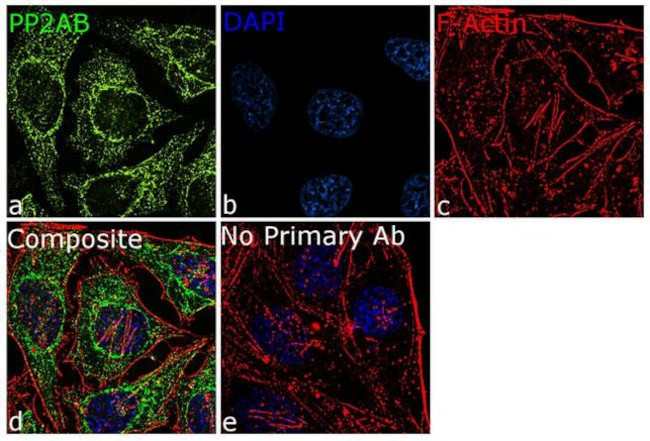 PPP2R2A Antibody in Immunocytochemistry (ICC/IF)