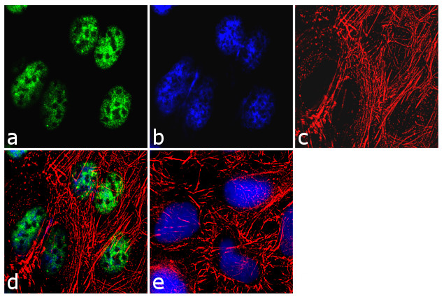 KMT2D Antibody in Immunocytochemistry (ICC/IF)