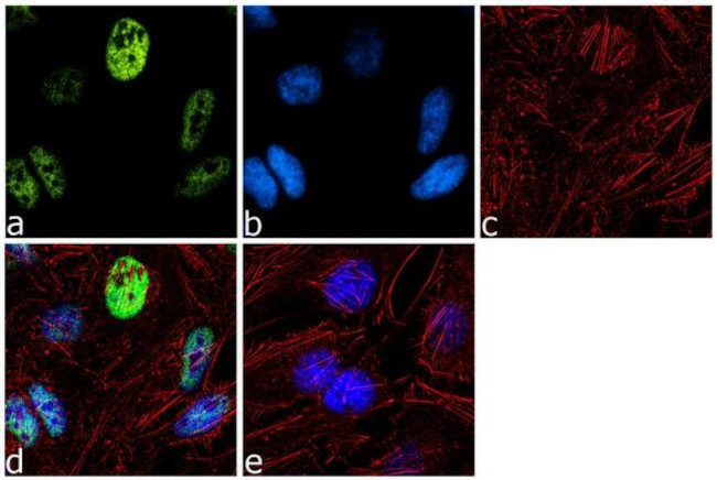 RNF20 Antibody in Immunocytochemistry (ICC/IF)