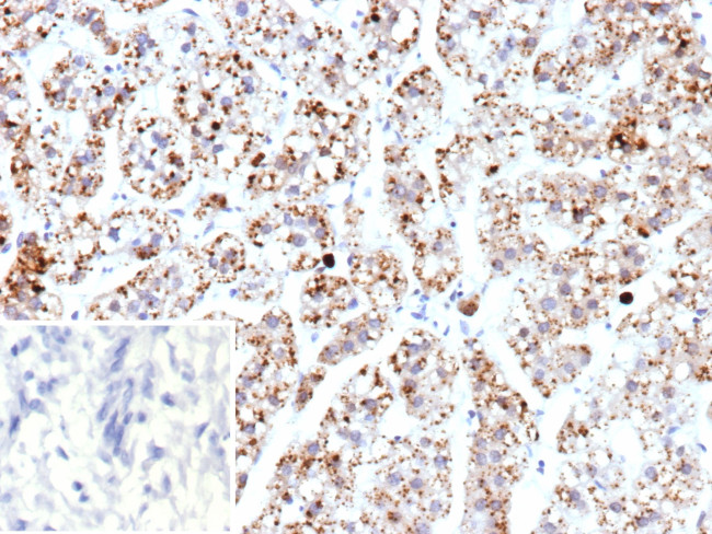 TFAM/TCF6 (Transcription factor A mitochondrial)/mtTFA Antibody in Immunohistochemistry (Paraffin) (IHC (P))