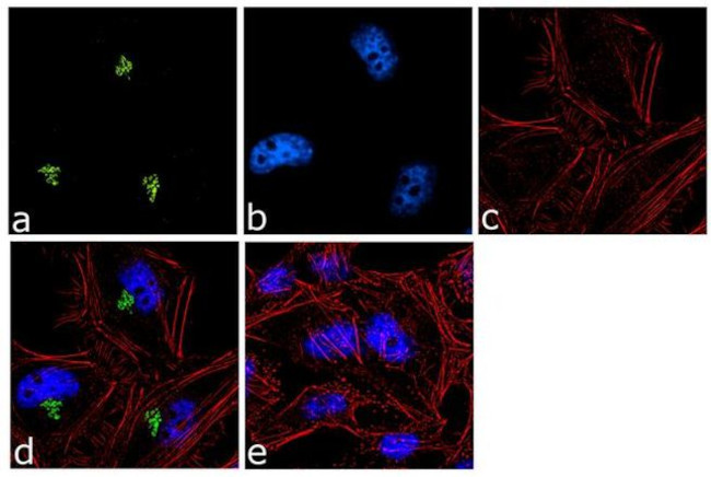 Spectrin beta-3 Antibody in Immunocytochemistry (ICC/IF)