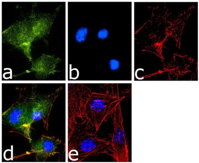 NOTCH2 Antibody in Immunocytochemistry (ICC/IF)