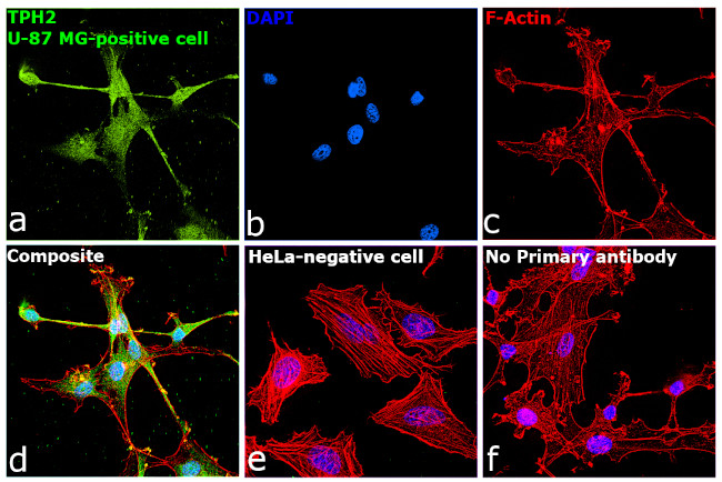 TPH2 Antibody in Immunocytochemistry (ICC/IF)