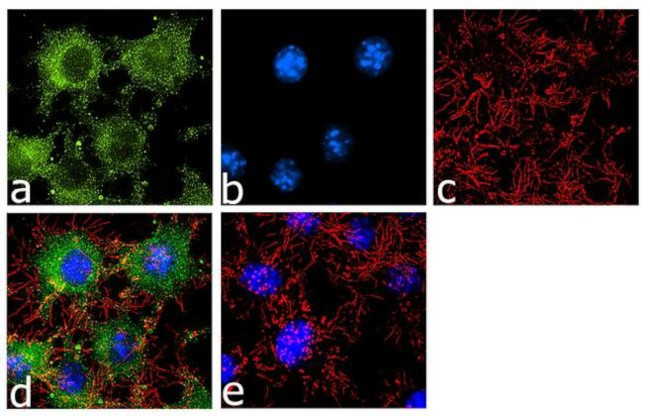 CCR5 Antibody in Immunocytochemistry (ICC/IF)