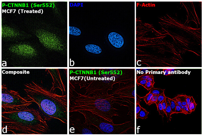 Phospho-beta Catenin (Ser552) Antibody in Immunocytochemistry (ICC/IF)