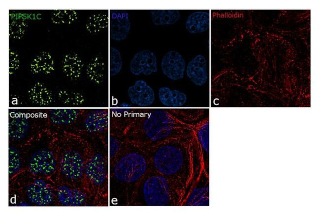PIP5K1C Antibody in Immunocytochemistry (ICC/IF)