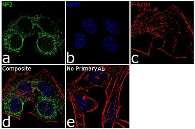 NF2 Antibody in Immunocytochemistry (ICC/IF)