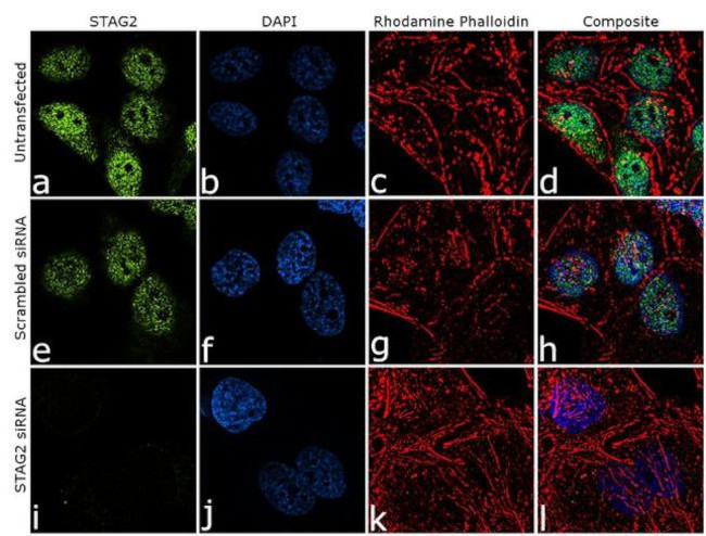 STAG2 Antibody in Immunocytochemistry (ICC/IF)