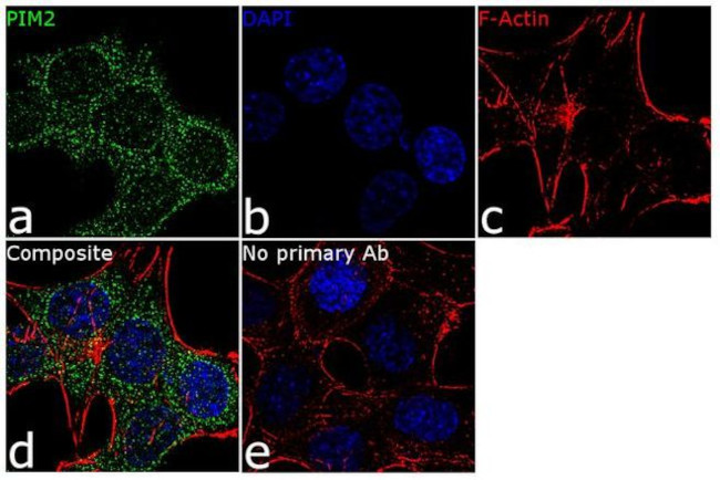PIM2 Antibody in Immunocytochemistry (ICC/IF)