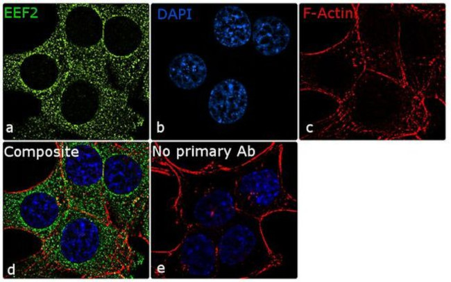 EEF2 Antibody in Immunocytochemistry (ICC/IF)