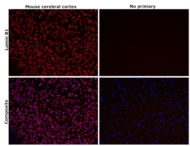 Lamin B1 Antibody in Immunohistochemistry (Paraffin) (IHC (P))