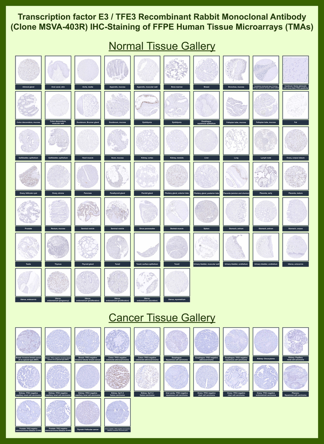 Transcription factor E3/TFE3 (Transcription Factor) Antibody in Immunohistochemistry (Paraffin) (IHC (P))