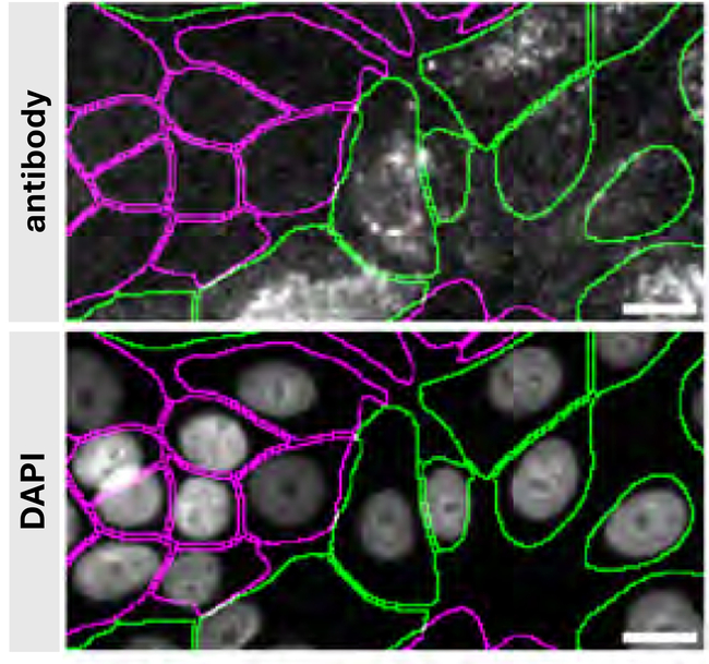 LIMP2 Antibody in Immunocytochemistry (ICC/IF)