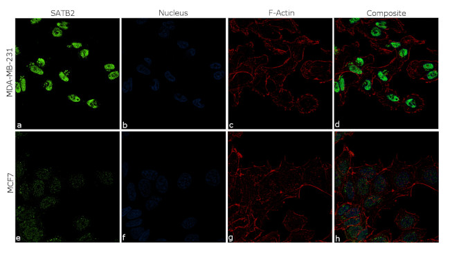 SATB2 Antibody in Immunocytochemistry (ICC/IF)