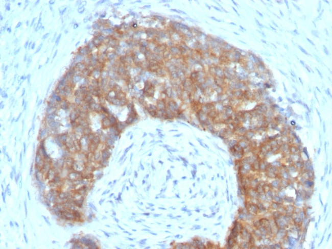 pS2/pNR-2/TFF1 (Estrogen-Regulated Protein) Antibody in Immunohistochemistry (Paraffin) (IHC (P))