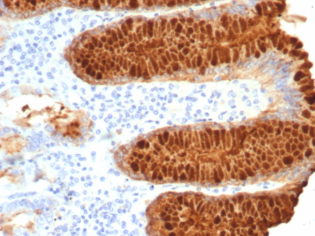 pS2/pNR-2/TFF1 (Estrogen-Regulated Protein) Antibody in Immunohistochemistry (Paraffin) (IHC (P))