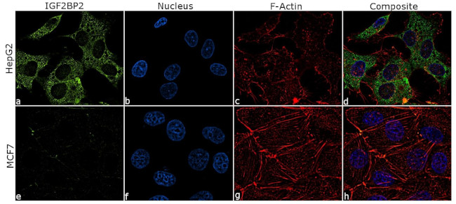IGF2BP2 Antibody in Immunocytochemistry (ICC/IF)