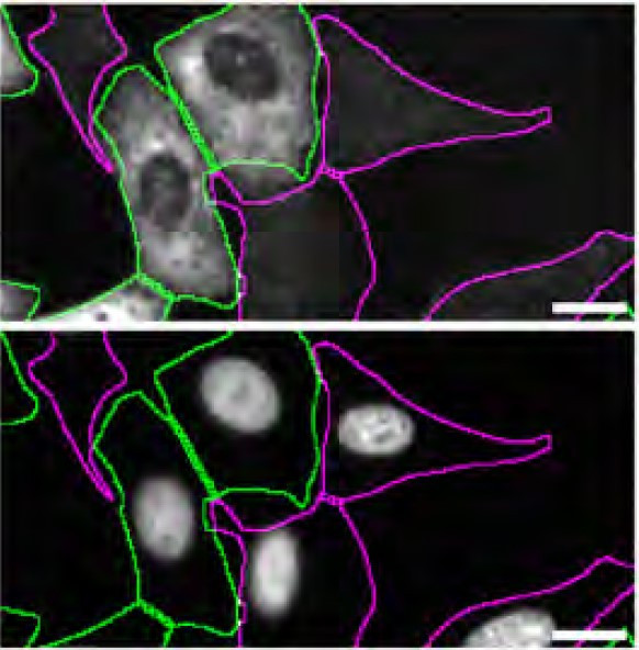 DDX1 Antibody in Immunocytochemistry (ICC/IF)