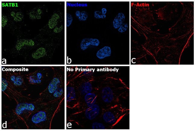 SATB1 Antibody in Immunocytochemistry (ICC/IF)