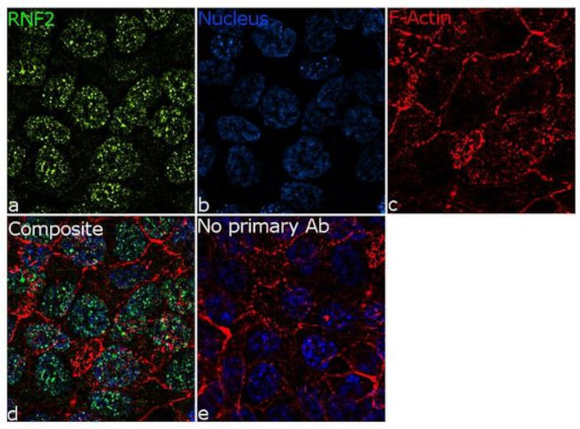 RNF2 Antibody in Immunocytochemistry (ICC/IF)