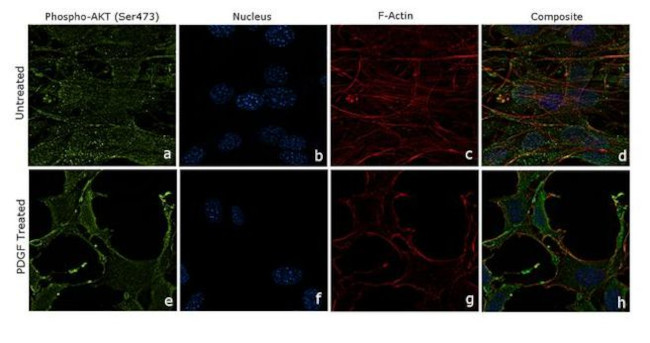Phospho-AKT1 (Ser473) Antibody in Immunocytochemistry (ICC/IF)