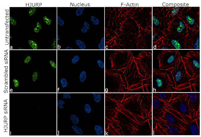 HJURP Antibody in Immunocytochemistry (ICC/IF)