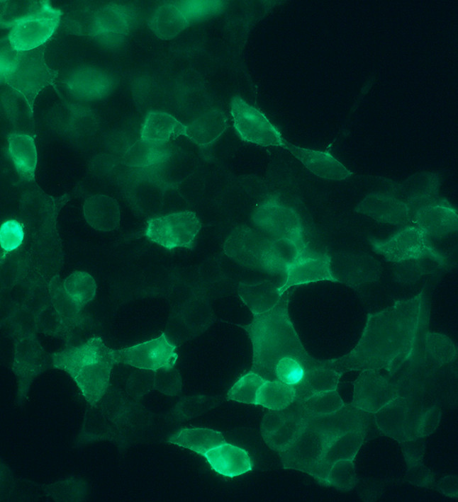 SSTR4 Antibody in Immunocytochemistry (ICC/IF)