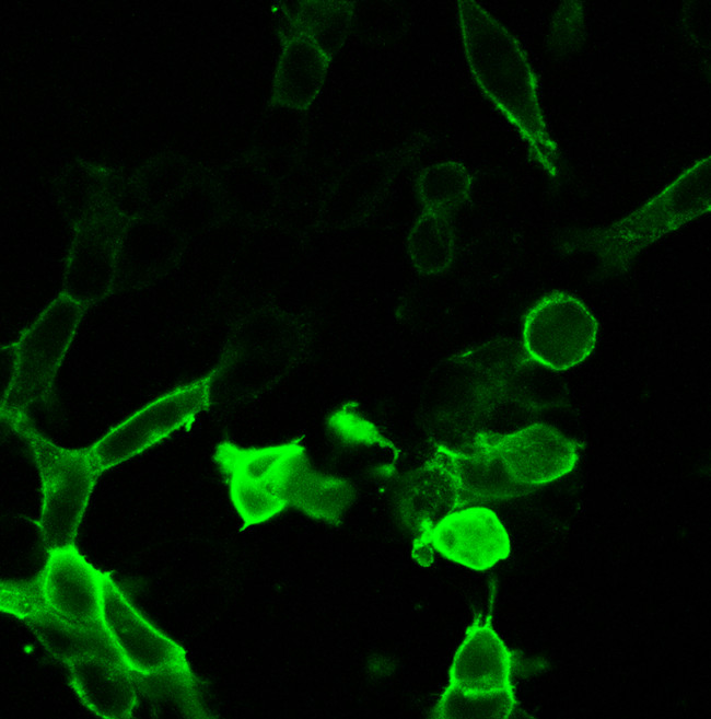 AVPR2 Antibody in Immunocytochemistry (ICC/IF)