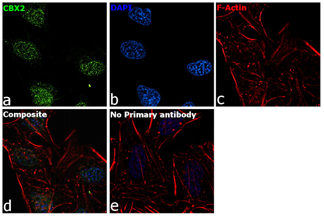 CBX2 Antibody in Immunocytochemistry (ICC/IF)