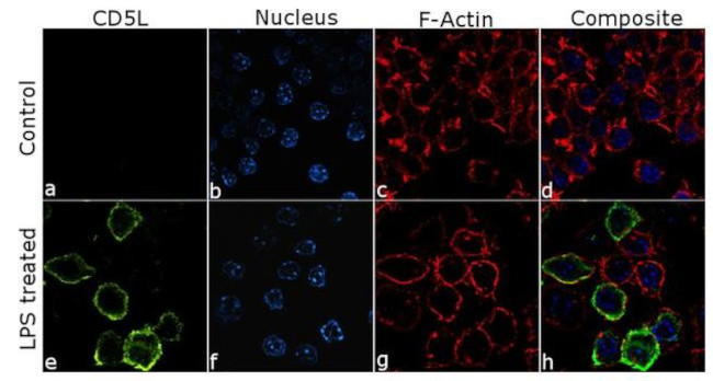 AIM Antibody in Immunocytochemistry (ICC/IF)